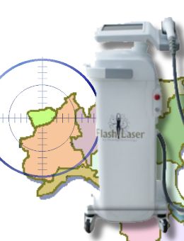 Laser Diodo Val d'Aosta epilazione